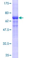 Human ACTG2 Protein (Recombinant GST)
