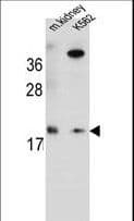 Polyclonal Rabbit anti-Human RNF185 Antibody (aa88-117, WB)