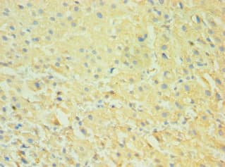 Polyclonal Rabbit anti-Human CALHM1 Antibody (aa202-346, IHC)