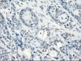 SSX2 Antibody (clone OTI4A11)