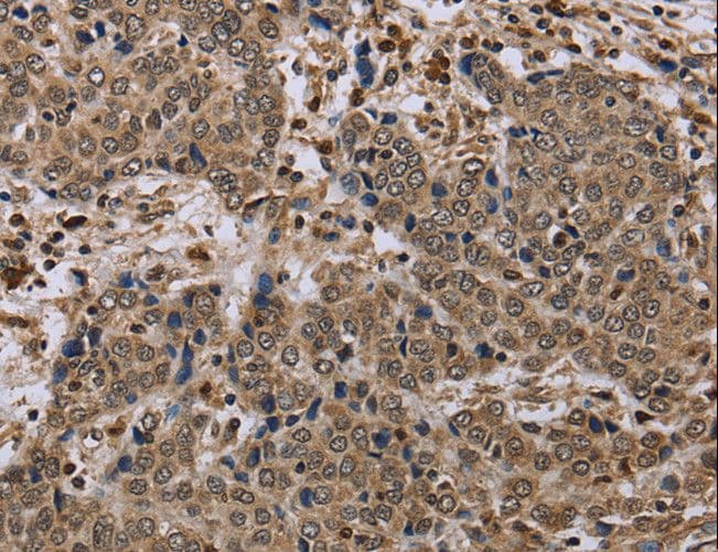 Polyclonal Rabbit anti-Human NALP4 / NLRP4 Antibody (IHC)