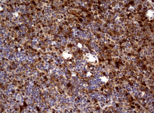 TP / Thymidine Phosphorylase Antibody (aa311-482, clone UMAB97)