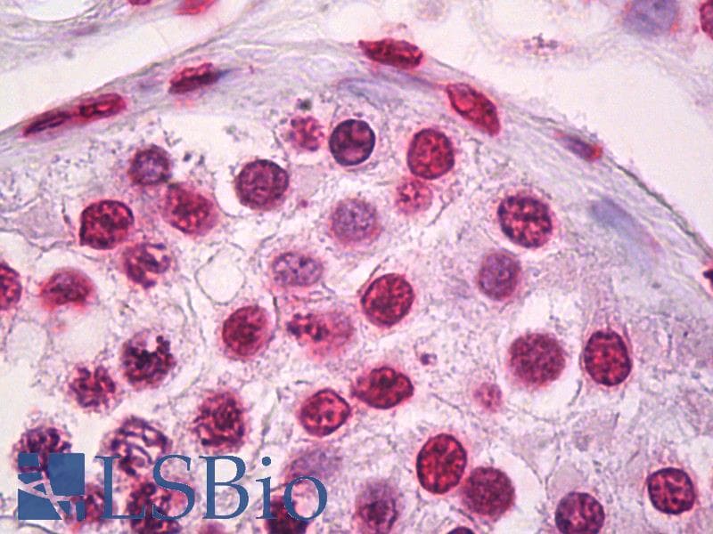 IHC-plus™ Monoclonal Mouse anti-Human HIPK1 Antibody (clone 1D6, IHC)