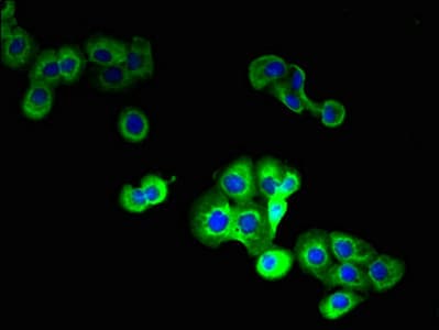 IHC-plus™ STEAP1 / STEAP Antibody (aa3-69)
