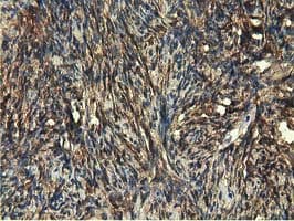 EPHX2 / Epoxide Hydrolase 2 Antibody (clone OTI1A6, Carrier-free)