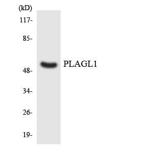 IHC-plus™ PLAGL1 / ZAC Antibody (aa298-347)
