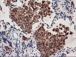SNX8 Antibody (clone OTI1E5)