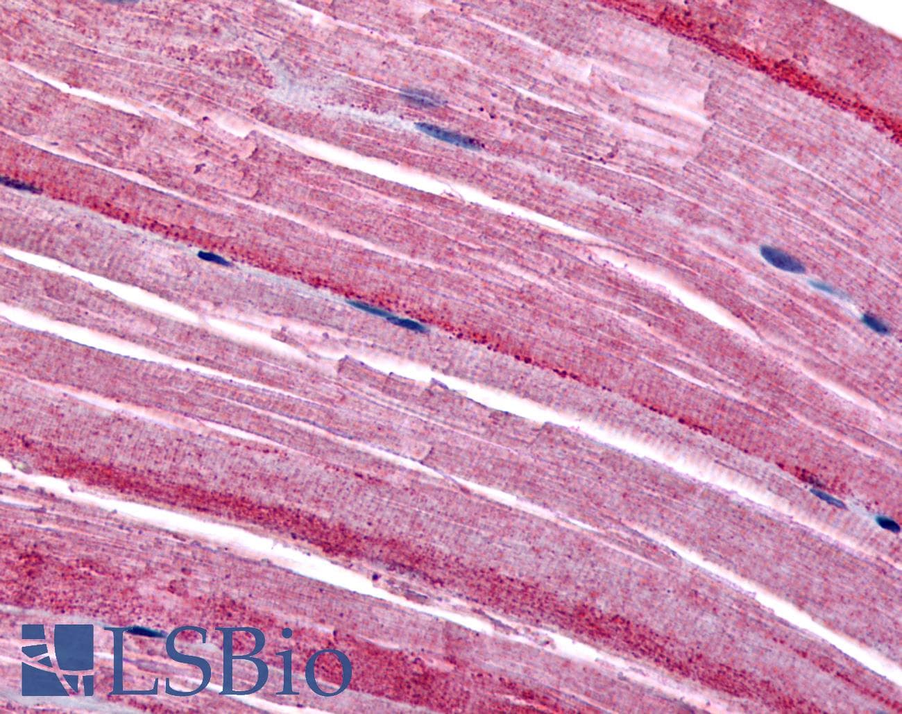 IHC-plus™ Polyclonal Rabbit anti-Human GRK5 Antibody (N-Terminus, IHC)