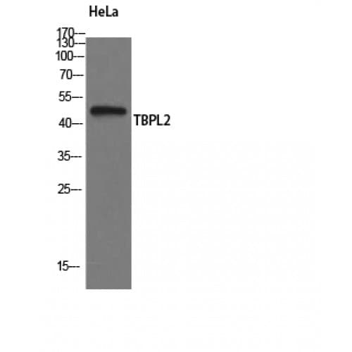TBPL2 / TRF3 Antibody (50-130 aa, Internal)