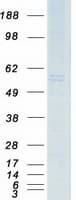 Human CAV2 / Caveolin 2 Protein (Recombinant Myc-DDK (Flag))