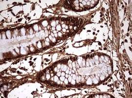 Monoclonal Mouse anti-Human GAPDH Antibody (clone OTI2F8, IHC, WB)