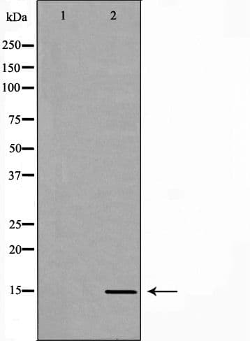 LHB / Luteinizing Hormone Antibody
