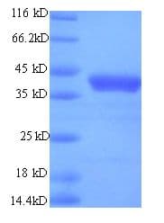 Human Regulatory Protein E2 (Recombinant His)