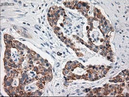 KRT18 / CK18 / Cytokeratin 18 Antibody (clone OTI1E1)