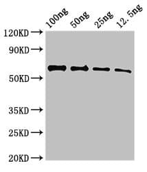 Polyclonal Rabbit anti-Human UNC80 Antibody (IF)