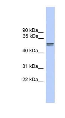 CDR2L Antibody (N-Terminus)