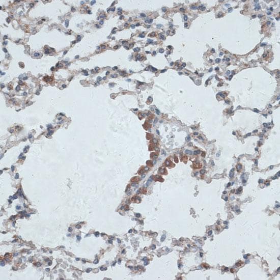 TMEPAI / PMEPA1 Antibody