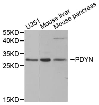 Polyclonal Rabbit anti-Human PDYN / ProDynorphin Antibody (IHC, WB)
