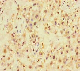 Polyclonal Rabbit anti-Human SQSTM1 Antibody (IHC, IF)