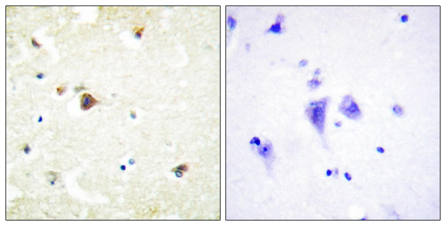 TRIM3 Antibody