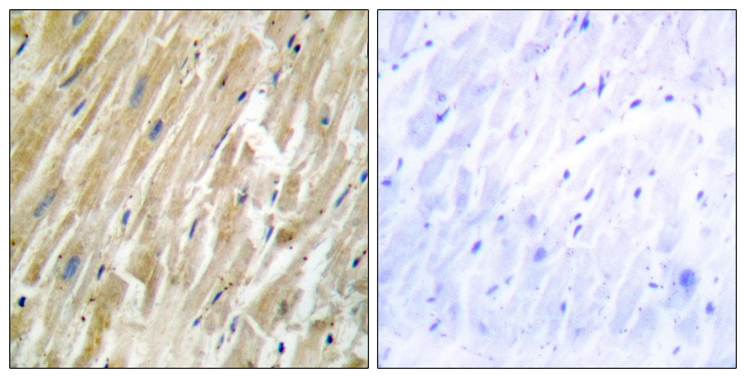 Polyclonal Rabbit anti-Human CALR / Calreticulin Antibody (IHC, IF, WB)