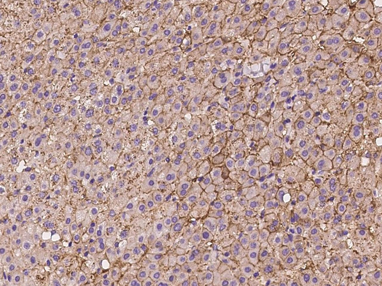 SLC22A7 / OAT2 Antibody