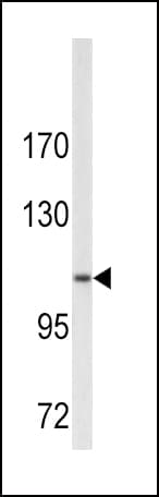 COL6A1 / Collagen VI Alpha 1 Antibody (aa48-77)