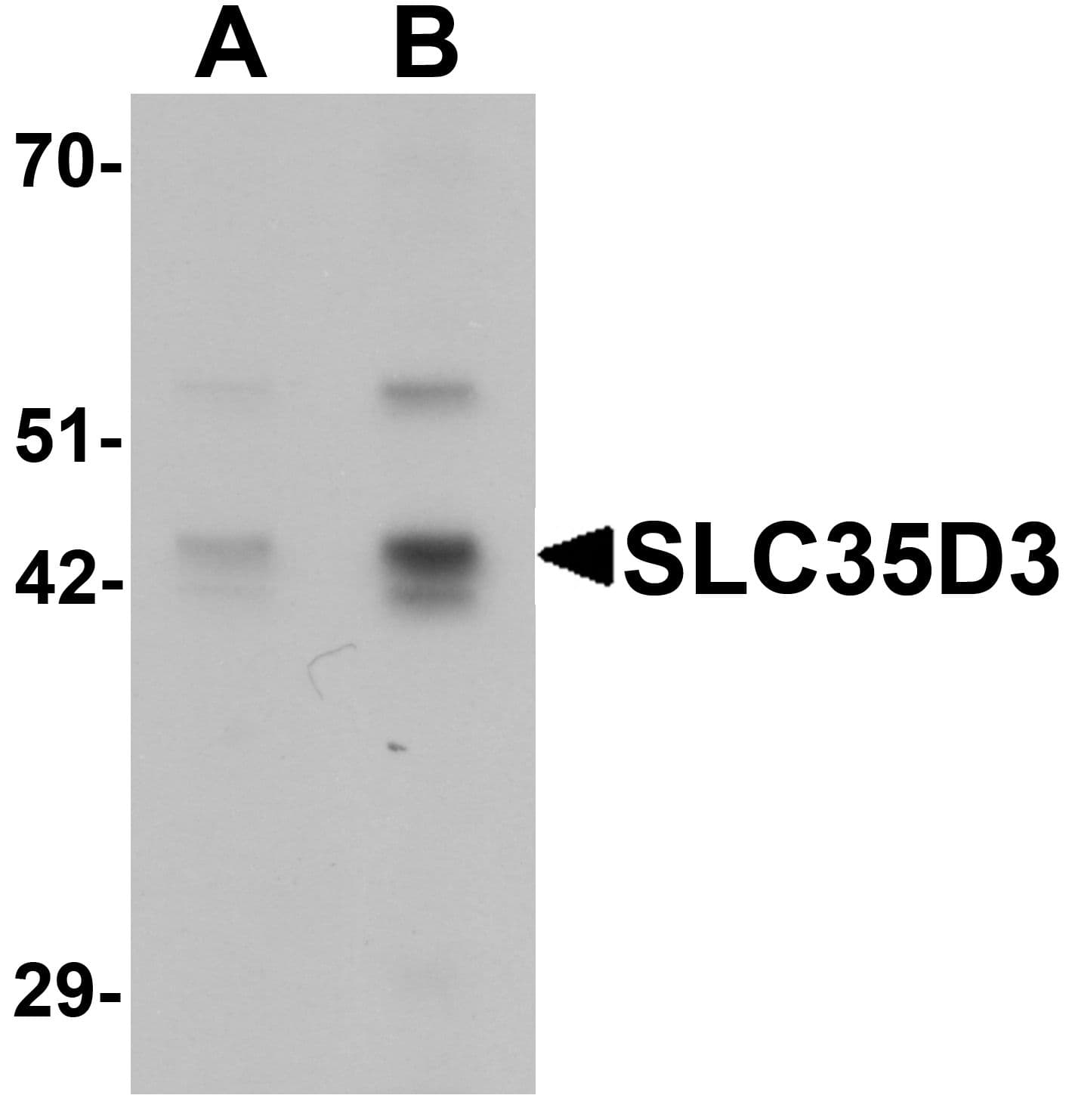 IHC-plus™ SLC35D3 / FRCL1 Antibody