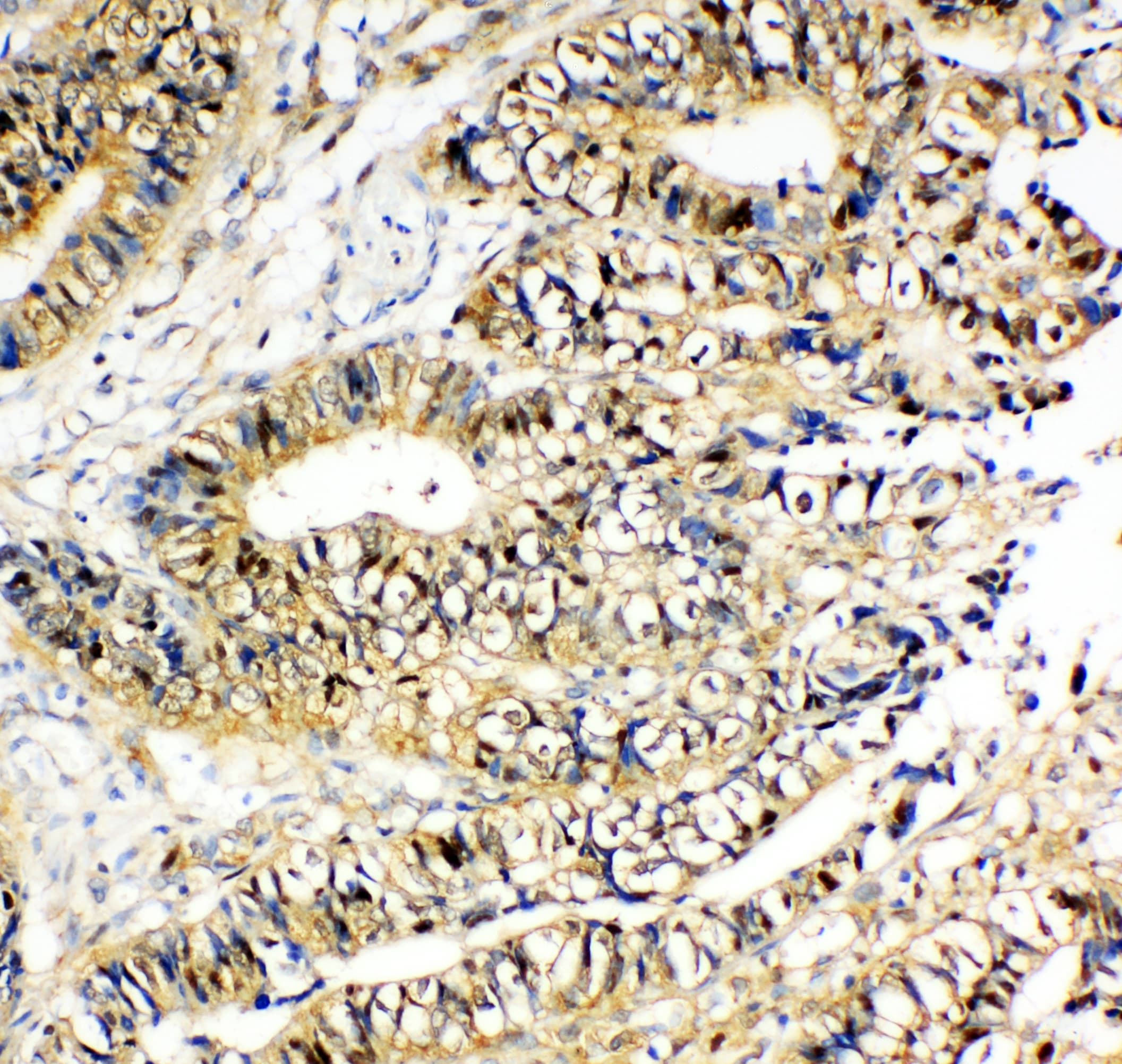 NME2 Antibody (aa137-152)