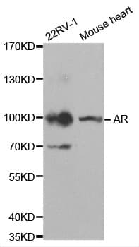 AR / Androgen Receptor Antibody