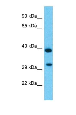 TMEM177 Antibody (aa241-290)