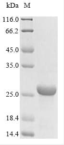 Bordetella pertussis fim3 Protein (Recombinant 6His, N-terminus)