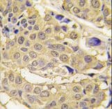 Polyclonal Rabbit anti-Human EPRS / PARS Antibody (aa285-314, IHC, WB)