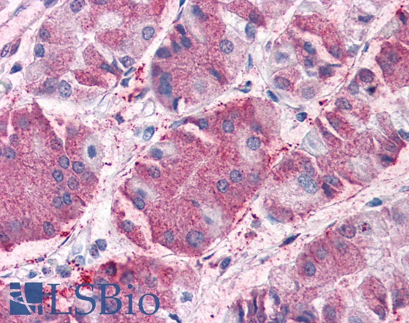 IHC-plus™ GCNT3 Antibody (Internal)