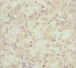 EFHC1 Antibody