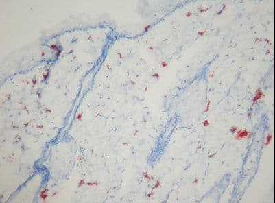 Macrophage Antibody (clone Ki-M2R)