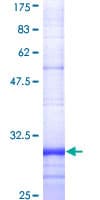 Human FPR2 / FPRL1 Protein (Recombinant GST, N-terminus)