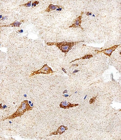 IDH3B Antibody (aa15-49)
