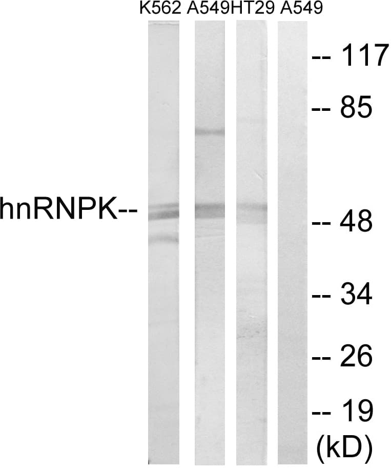 HNRNPK / hnRNP K Antibody (aa250-299)