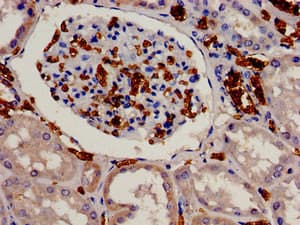 Polyclonal Rabbit anti-Human EIF3J Antibody