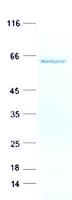 Human SPATA6 / SRF-1 Protein (Recombinant His, N-Terminal)