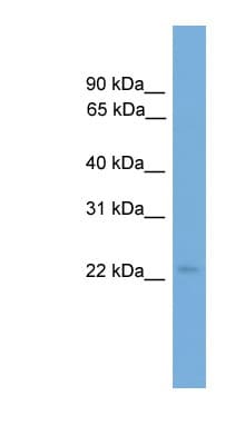 Polyclonal Rabbit anti-Human COPS8 / COP9 Antibody (C-Terminus, WB)