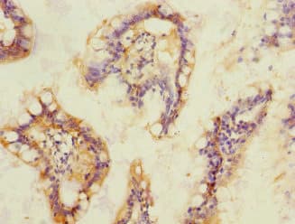 SOAT2 Antibody