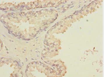 GTF2A2 / TFIIA Antibody