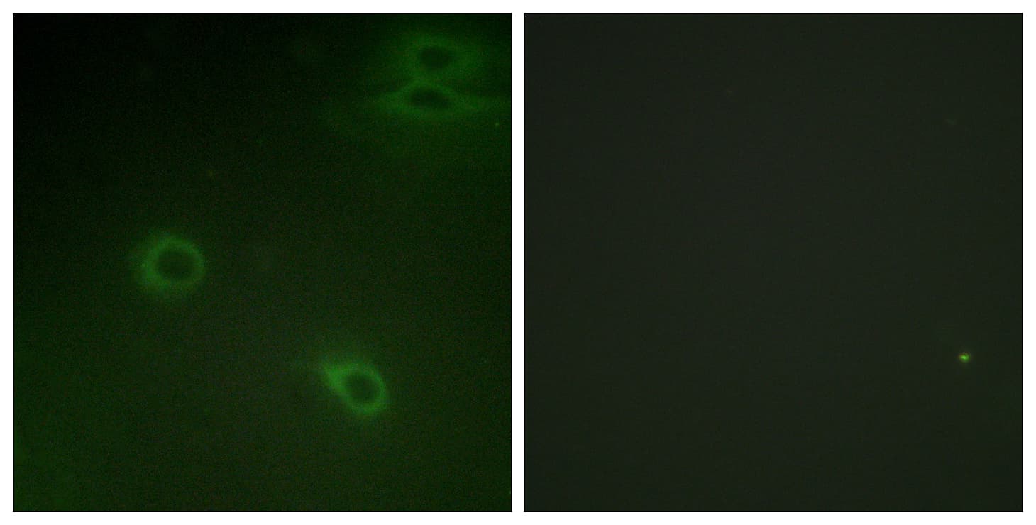 CXCR4 Antibody (phospho-Ser339)