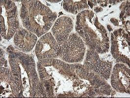 UBE2G2 Antibody (clone OTI4E12)