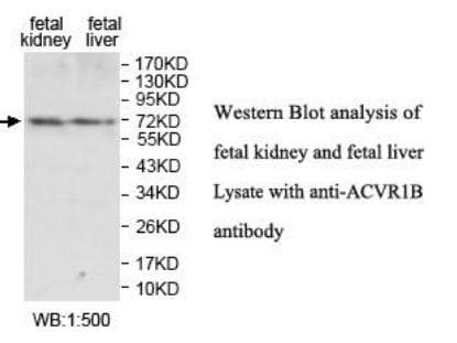 ACVR1B / ALK4 Antibody (aa154-415)