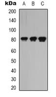 LRRC41 Antibody (Internal)