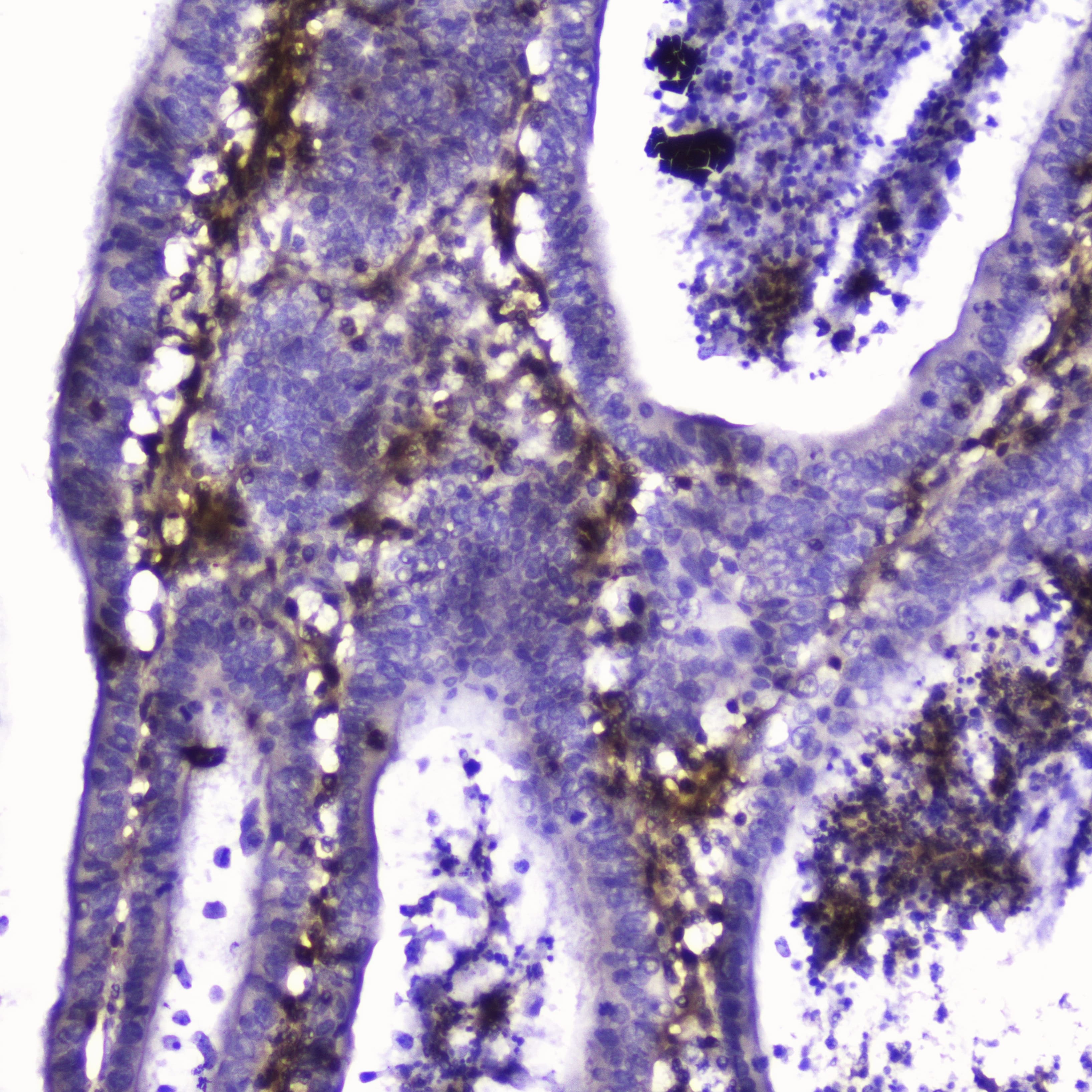 TLN1 / Talin 1 Antibody