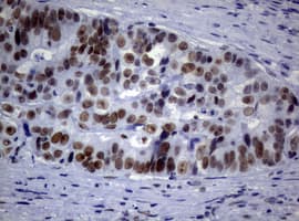 NBN / Nibrin Antibody (clone OTI1F11)
